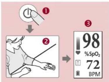 ① ↓ ② → ③ 98 %SpO₂ 72 BPM