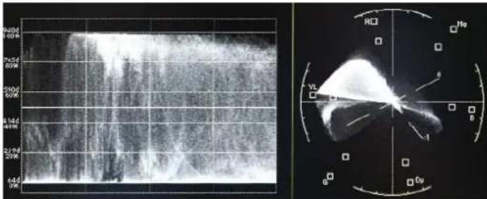 Medical ultrasound image with corresponding radiographic scan and coordinate system diagram