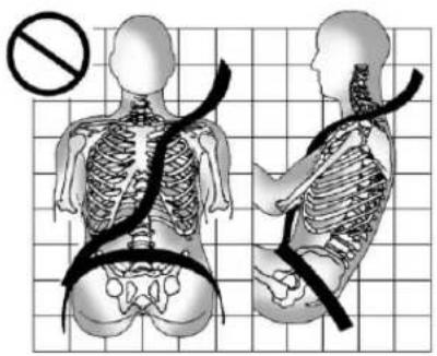 Medical illustration showing human skeletal anatomy with a no-smoking symbol, including side and front views of the torso and spine.