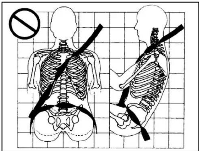 Medical illustration showing human skeletal anatomy with a no-smoking symbol, including left and right views of the spine and shoulder.