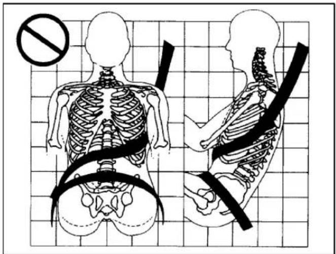 Medical illustration showing human skeletal anatomy with a no-smoking symbol and corresponding side views of the torso.
