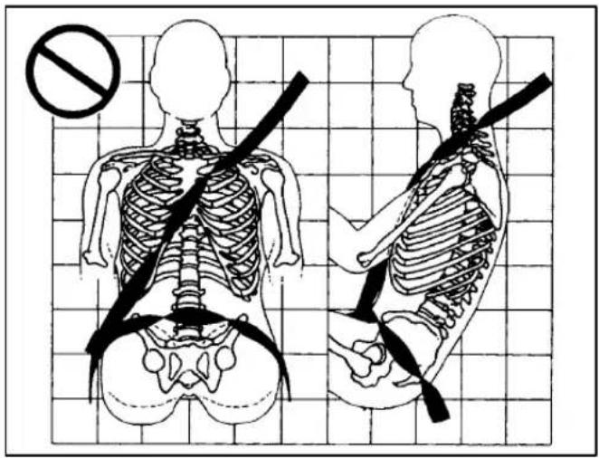 Medical illustration showing human skeleton with a no-smoking symbol and a side view of the lower torso with a bandage.