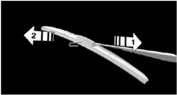 Close-up of a medical or surgical tool with two labeled arrows (1 and 2) pointing to a curved, elongated object against a black background (no text or symbols on the tool itself)