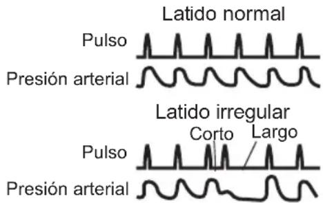 Latido normal Pulso Presión arterial Latido irregular Corto Largo Pulso Presión arterial