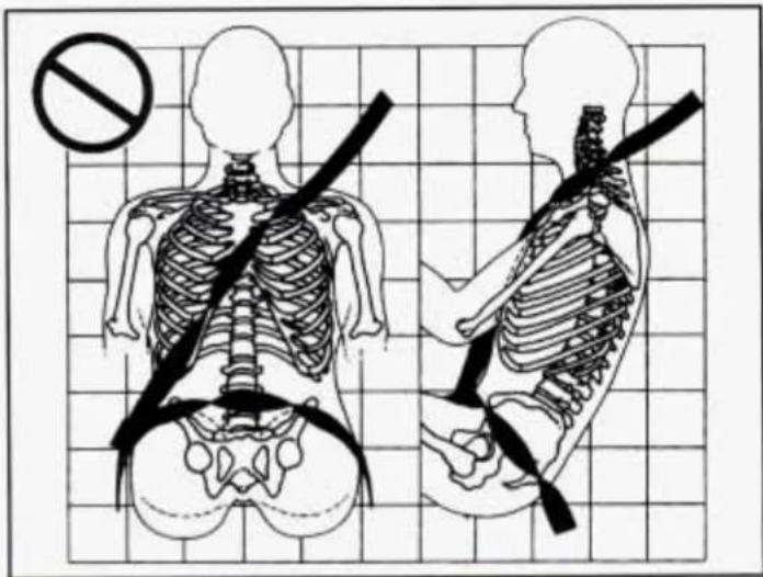 Medical illustration showing human skeletal anatomy with a no-smoking symbol, including left and right views of the torso and spine.