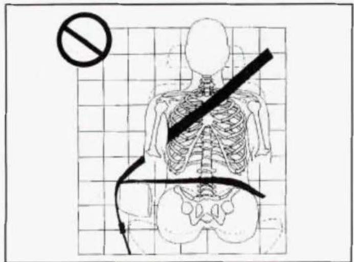 Diagram showing a human skeleton with a diagonal line and a no-smoking symbol, likely indicating a risk or absence of an outcome.
