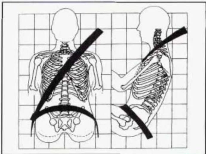 Illustration of human torso and pelvis with a diagonal belt, shown in side and top views (no text or labels)