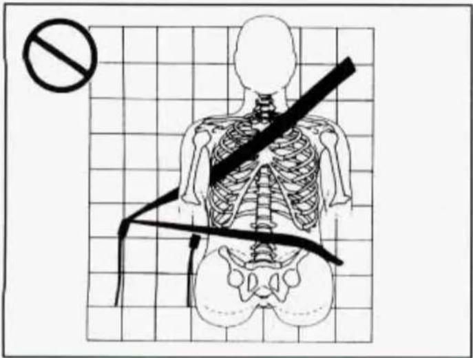 Medical diagram showing a human skeleton with a diagonal band crossing, accompanied by a no-smoking symbol.