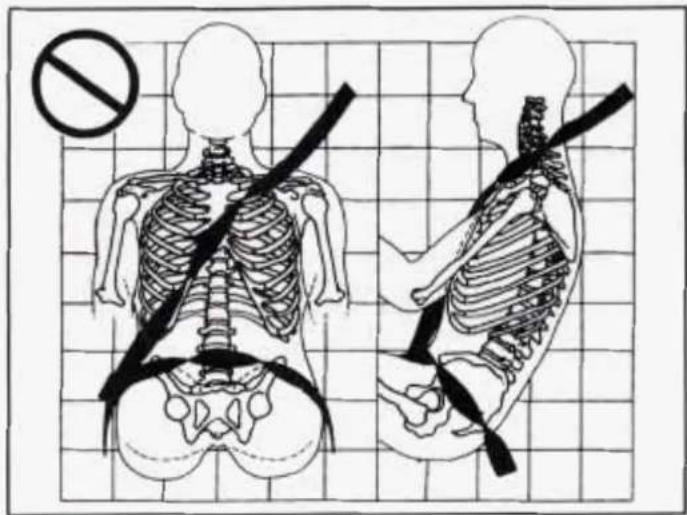 Medical illustration showing human skeletal anatomy with a no-smoking symbol, including left and right views of the spine and shoulder.