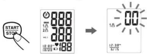 START STOP 988 1.8 2.8 WLI 200 10:00" 18/28 188 → 00 1.8 12:30" 6/15