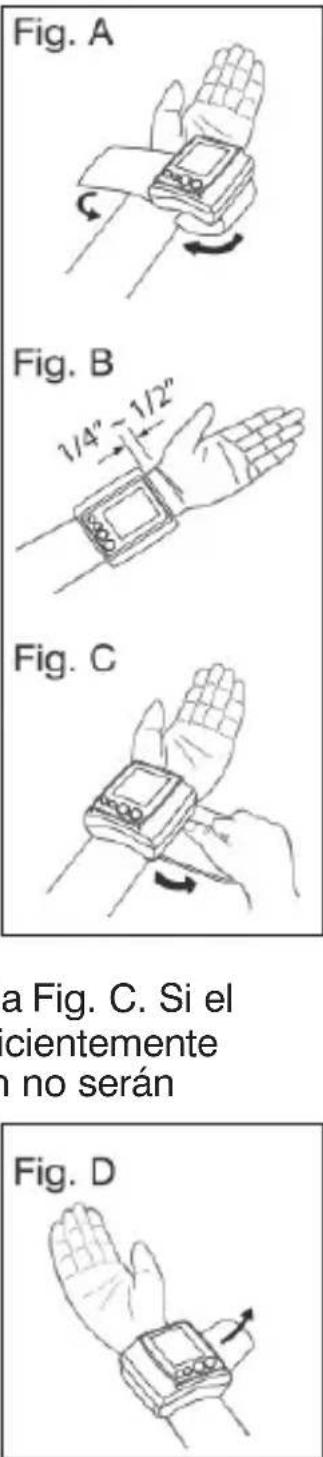Fig. A Fig. B 1/4" - 1/2" Fig. C a Fig. C. Si el cientemente n no serán Fig. D
