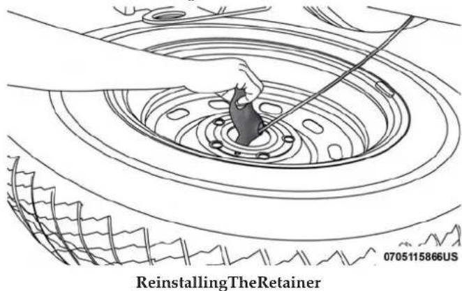 ReinstallingTheRetainer 0705115866US
