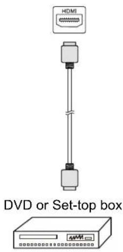 HDMI DVD or Set-top box