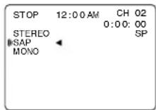 PANASONIC PV-D4744 - SAP broadcast - 1