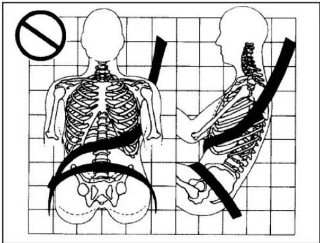 Medical illustration showing front and side views of human skeletal anatomy with a no-smoking symbol above the spine.
