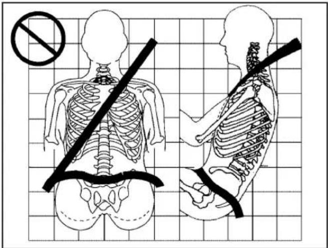 Medical illustration showing human skeletal anatomy with a no-smoking symbol and corresponding side views of the spine.
