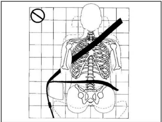 Medical diagram showing human skeleton with a diagonal line and a no-smoking symbol, overlaid on a grid background.