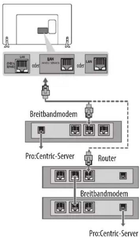 LG 32LX300C - Kabelgebundene Netzwerkverbindung - 1
