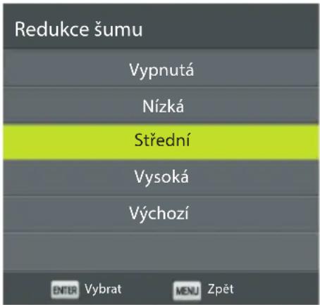 ECG 24 H03T2S2 - Redukce šumu - 1