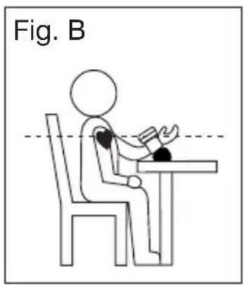 Fig. B