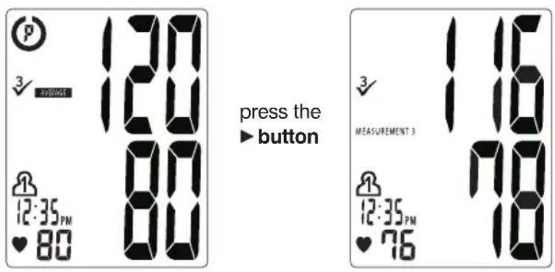 12:00 3 12:00 12:35 PM 80 1 12:35 PM 76 press the button 116 3 MEASUREMENT 3 116 12:35 PM 76