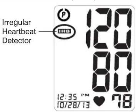 Irregular Heartbeat Detector 12:35 PM 10/28/13 120 120 80 78