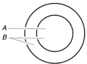 A B