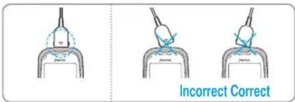 Incorrect Correct