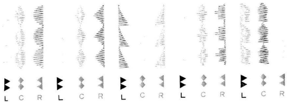 Diagram showing waveform patterns with labeled symbols L, C, R and corresponding waveform labels in English and Chinese.
