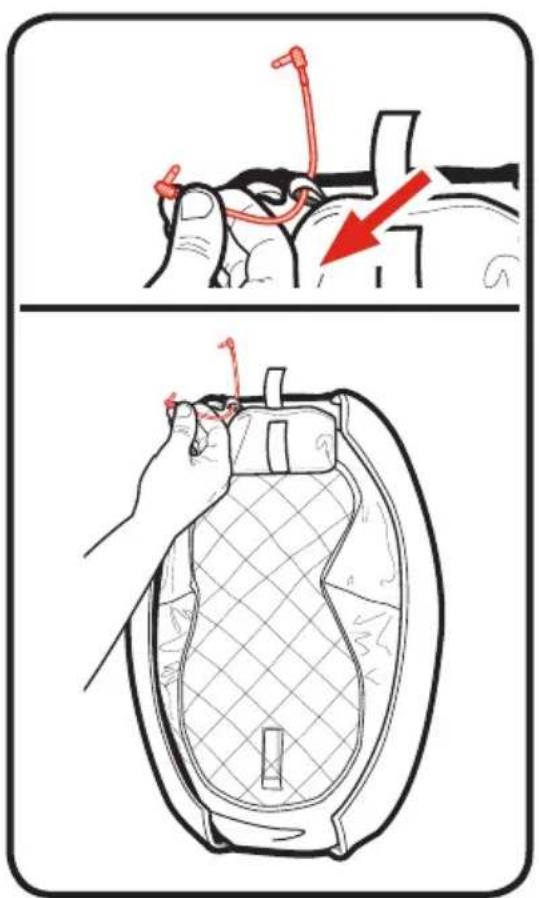 Medical illustration showing a hand performing a laparoscopic procedure with a red arrow indicating the motion direction.