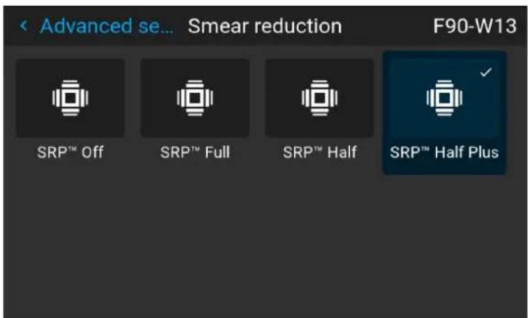 Advanced se... Smear reduction F90-W13 SRPTM Off SRPTM Full SRPTM Half SRPTM Half Plus
