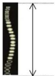 SAMSUNG Accuvix XQ - Measurement Points - 9