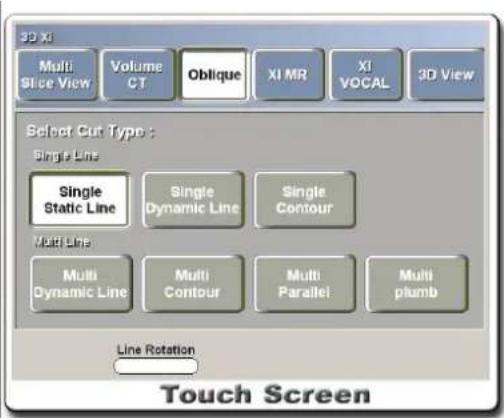 3D Xi Multi Slice View Volume CT Oblique XI MR XI VOCAL 3D View Select Cut Type : Single Line Single Static Line Single Dynamic Line Single Contour Multi Line Multi Dynamic Line Multi Contour Multi Parallel Multi plumb Line Rotation Touch Screen