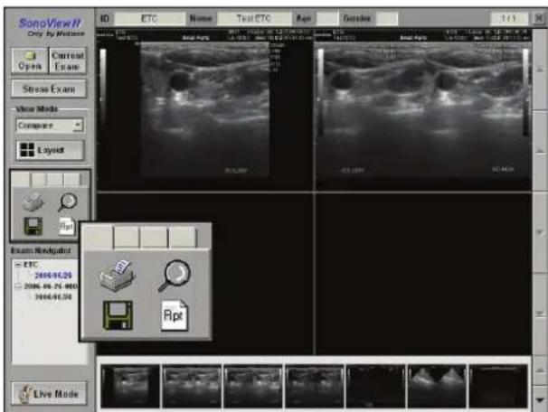 SonoView1 Only by Modems Current Open Exane Stress Exam Show Mode Compare Layout Exam Navigator = ETC 2006-04.29 2006-04.29 00:00 2006-04.30 Live Mode ID ETC Name也有ETC Rpt Garden 1:11 ISO