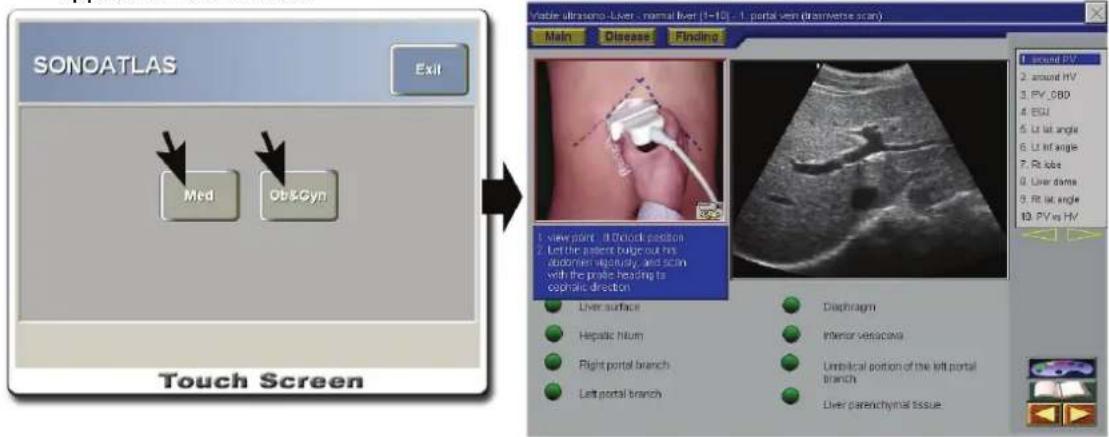 SONOATLAS Exit Med Ob&Gyn Touch Screen Main Disease Finding 1. view plant: 3 Ocular portion 2. Let the parent buge out his abdomen elegantly, and scan with the probe heading to cognitive direction Liver surface Hepatic hilum Right portal branch Left portal branch Diaphragm Inferior vesicemia Umbilical portion of the left portal branch Liver parenchymal tissue