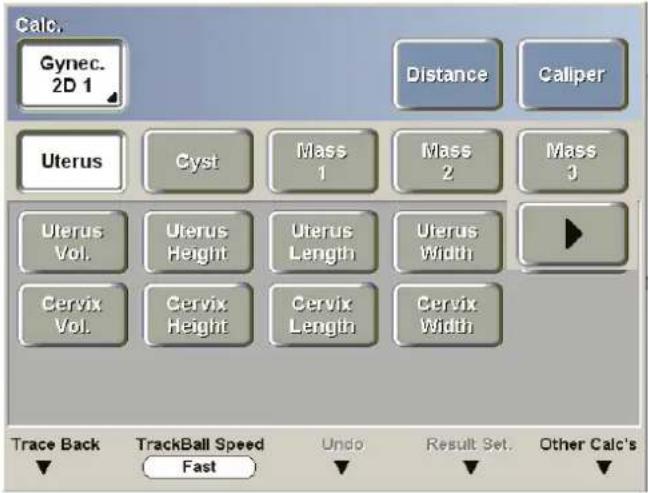 Calc. Gynec. 2D 1 Distance Caliper Uterus Cyst Mass 1 Mass 2 Mass 3 Uterus Vol. Uterus Height Uterus Length Uterus Width Cervix Vol. Cervix Height Cervix Length Cervix Width Trace Back TrackBall Speed Fast Undo Result Set. Other Calc's