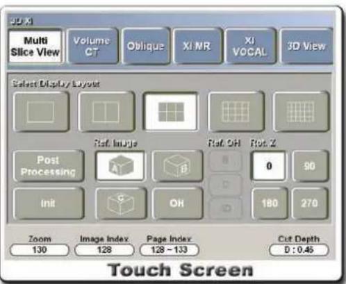 3D X Multi Slice View Volume CT Oblique XI MR XI VOCAL 3D View Select Display Layout Post Processing Ref: Image B Ref: OH 0 90 Init OH 180 270 Zoom Image Index Page Index Cut Depth 130 128 128 ~ 133 D : 0.45 Touch Screen