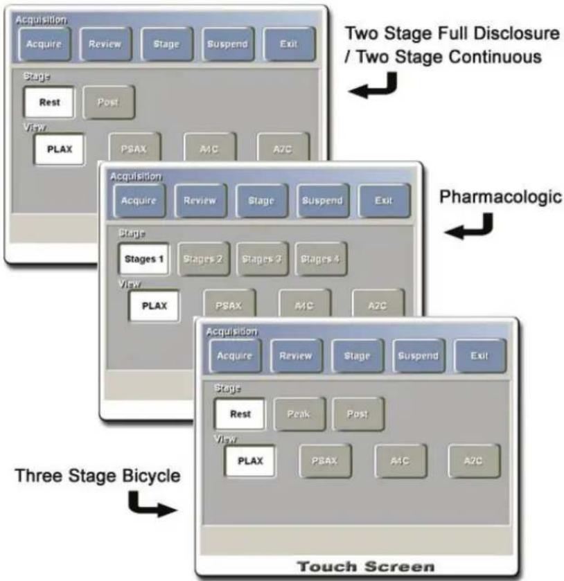 SAMSUNG Accuvix XQ - Exercise Stress Echo Program - 2