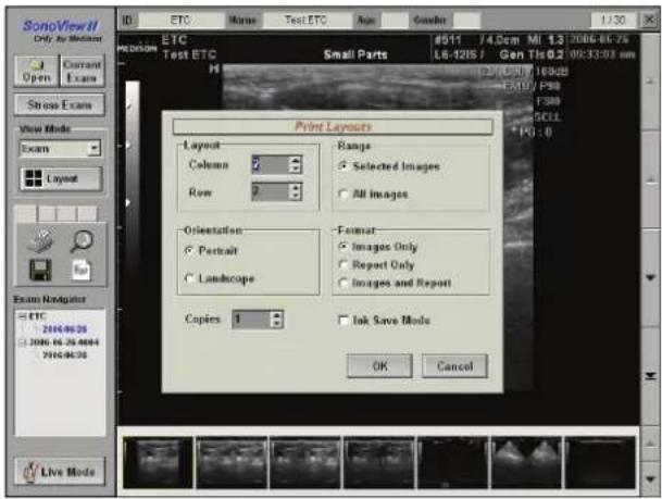 SonoView II Only by Medium Open Current Exam ETC Test ETC Small Parts L6-12IS / Gen Tls0.2 1:30 4511 / 4.0cm MI 1.3 086-60-75 09:33:03 nm Print Layouts Layout Column Range Row Selected Images All Images Orientation Format Portrait Images Only Landscape Report Only Images and Report Copies 1 Ink Save Mode OK Cancel Stress Excurs View Mode Exam Layout Exam Rodriguez ETC 2006.16.28.4884 2006.16.28.4884 2006.16.28.4884 2006.16.28.4884 Live Mode