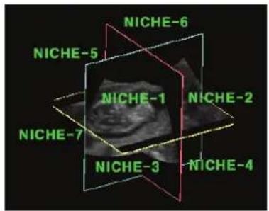 NICHE-6 NICHE-5 NICHE-1 NICHE-2 NICHE-7 NICHE-3 NICHE-4