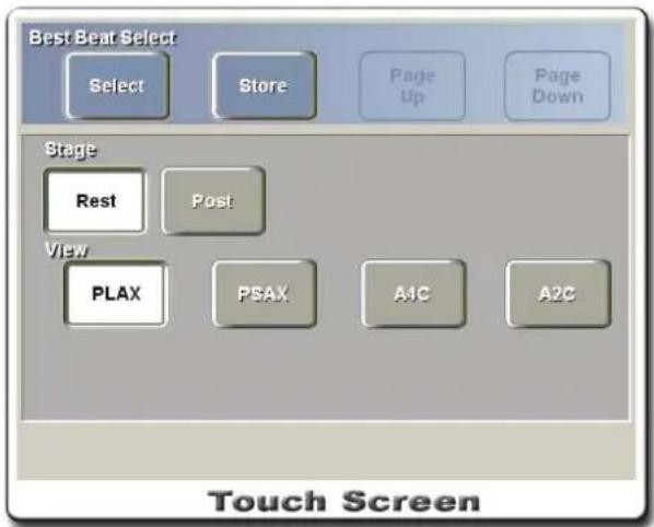 Best Beat Select Select Store Page Up Page Down Stage Rest Post View PLAX PSAX A1C A2C Touch Screen