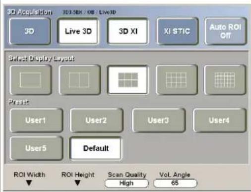 3D Acquisition 3D SEK / OB : Live3D 3D Live 3D 3D XI XI STIC Auto ROI OFF Select Display Layout Preset User1 User2 User3 User4 User5 Default ROI Width ROI Height Scan Quality Vol. Angle High 65