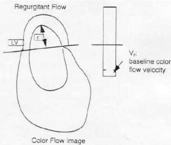 Regurgitant Flow LV r Color Flow Image Vr: baseline color flow velocity
