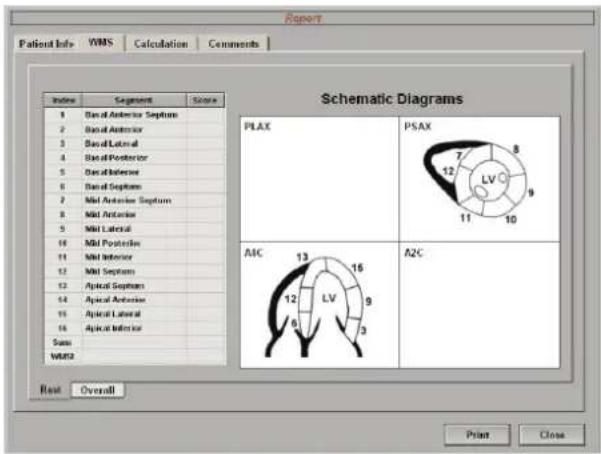 Schematic Diagrams PLAX PSAX A1C A2C Rest Overall Print Close Patient Info VIMS Calculation Comments Index Segments Source 1 Base Anterior Septum 2 Base Anterior 3 Base Lateral 4 Base Posterior 5 Base Inferior 6 Base Sepsis 7 Mid Anterior Septum 8 Mid Anterior 9 Mid Lateral 10 Mid Posterior 11 Mid Inferior 12 Mid Sepsis 13 Optical Sepsis 14 Optical Atherosclerosis 15 Optical Lateral 16 Optical Inferior Sum VMS2