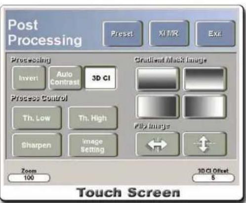 Post Processing Preset X1 MR Exit Processing Invert Auto Contrast 3D CI Gradient Mask Image Process Control Th. Low Th. High Shift Image Sharpen Image Setting Zoom 100 3D CI Offset 8 Touch Screen