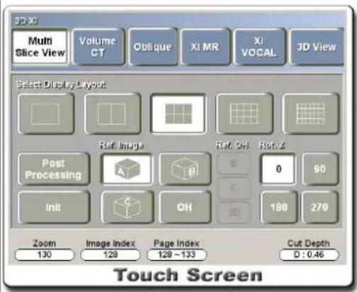 3D X Multi Slice View Volume CT Oblique XI MR XI VOCAL 3D View Select Display Layout Ref. Image Ref. OH Rot. Z Post Processing A B 0 90 C 180 270 Init C OH Zoom Image Index Page Index Cut Depth 130 128 128~133 D:0.46 Touch Screen