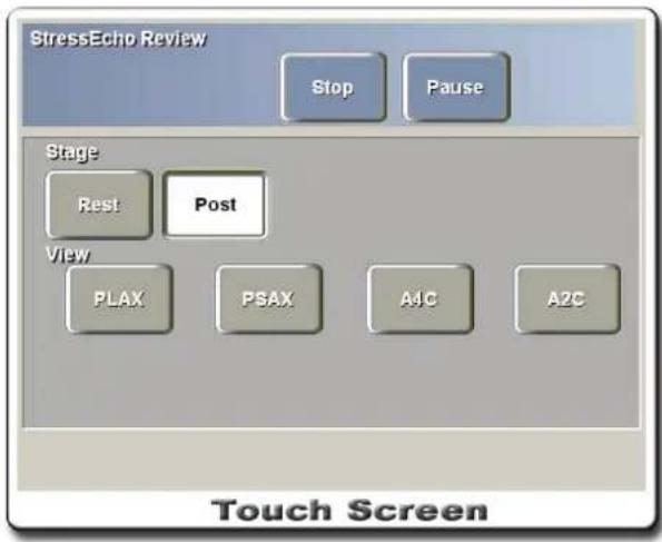 StressEcho Review Stop Pause Stage Rest Post View PLAX PSAX A4C A2C Touch Screen
