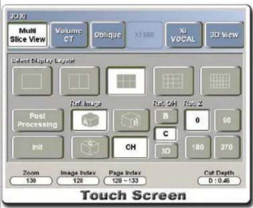 3D Xi Multi Slice View Volume CT Oblique Xi MR Xi VOCAL 3D View Select Display Layout Post Processing Ref. Image B Ref. OH B 0 90 C Init G OH 3D 180 270 Zoom Image Index Page Index Cut Depth 130 128 128 ~ 133 D : 0.46 Touch Screen