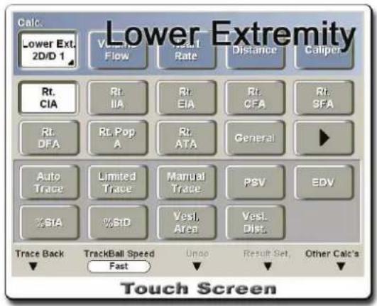 Lower Extremity Calc. Lower Ext. 2D/D 1 Flow Rate Distance Caliper Rt. CIA Rt. IIA Rt. EIA Rt. CFA Rt. SFA Rt. DFA Rt. Pop A Rt. ATA General Auto Trace Limited Trace Manual Trace PSV EDV %StA %StD Vest. Area Vest. Dist. Trace Back TrackBall Speed Unoo Result Set Other Calc's Fast Touch Screen