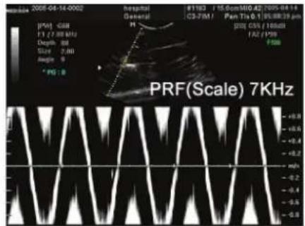 2005-04-14-0002 hospital General #1182 / 15 GunS10.42/705 04 19 C3-FM / Pen Tis 0.1 / 95/88:39 pm pos CIs % 10bitus FAZ FMS PRF(Scale) 7KHz +0.0 +0.0 +0.4 +0.2 -0.2 -0.4 -0.6 -0.8
